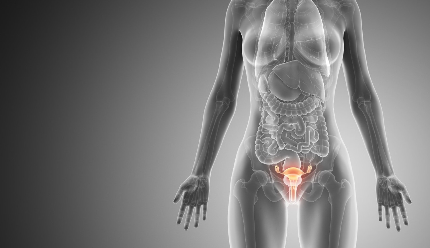 Endometriosis and Adenomyosis