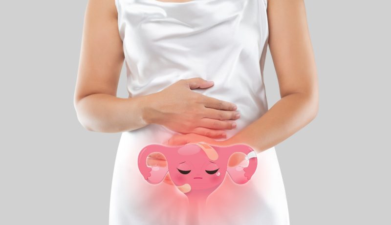 Endometriosis and Adenomyosis